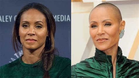 Jada Pinkett Smiths Plastic Surgery Before And After Changes Examined