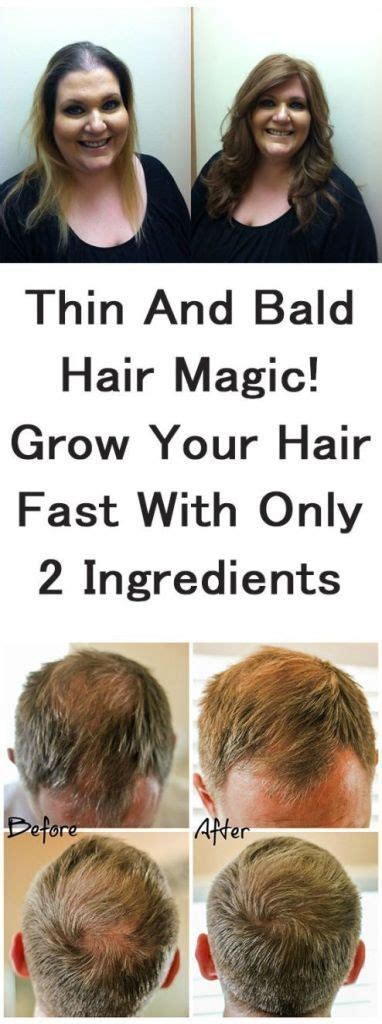 Hair Thinning Tips You Can Start Doing Today How To Grow Your Hair