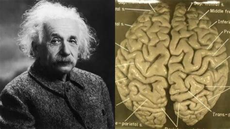 How Albert Einstein Brain Is Really Different Than Others Youtube