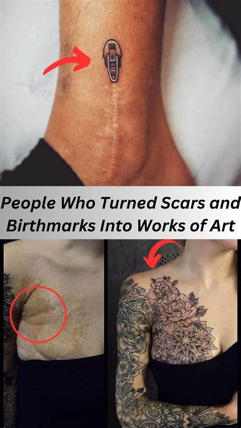 Tattoo Artists Who Turned Scars And Birthmarks Into Works Of Art Artofit