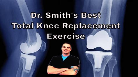 What Is The Best Total Knee Replacement Exercise Youtube