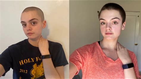 1 Month Shaved Head Growth Update Youtube