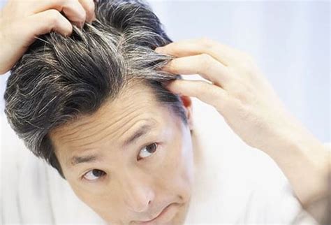 Premature Gray Hair Causes In Teens At 20 30 Home Remedies