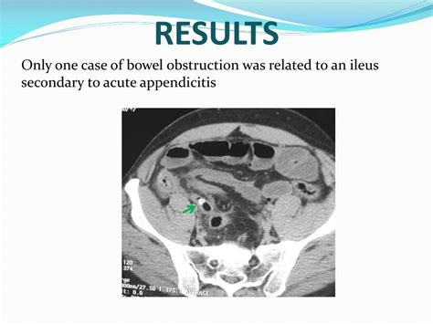 Ppt New Approach To Acute Bowel Obstruction By Multidetector Ct