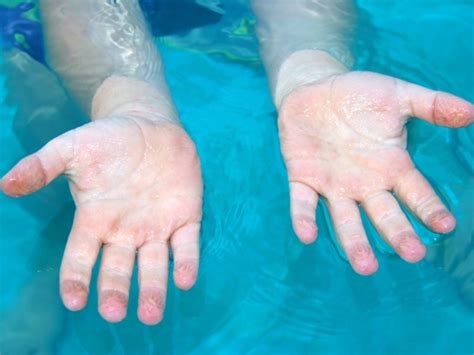 Heres Why Your Fingers And Toes Wrinkle Under Water Healthy Living