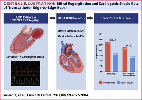 Transcatheter Edge To Edge Mitral Valve Repair In Patients With Severe