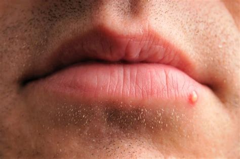 The 13 Causes Of Swollen Lips You Should Definetly Be Aware Of