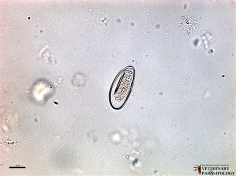 Ovos De Enterobius Vermicularis