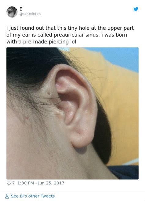People Are Realizing That Those Tiny Holes Above Their Ears May Have An