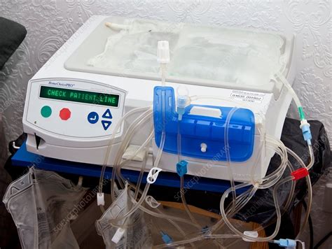 Peritoneal Dialysis Baxter Homechoice Pd System