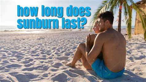 How Long Does Sunburn Last A Comprehensive Guide