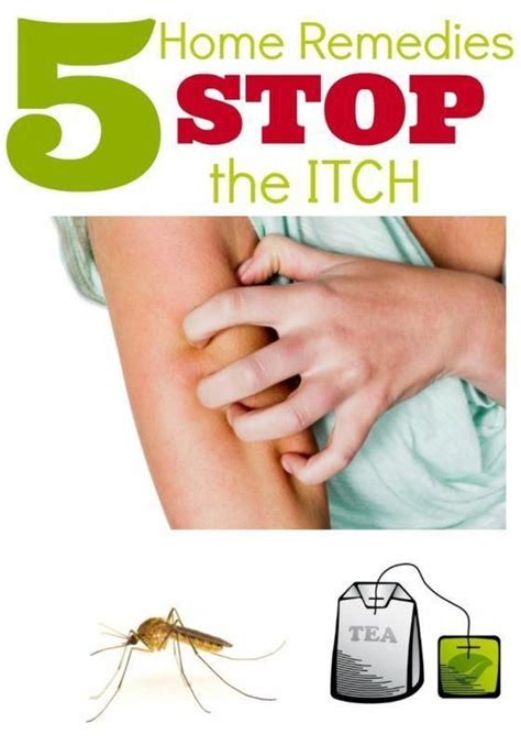 Stop That Mosquito Itch Now Home Remedies For Bug Bites No More Itching Itchrelief Bug