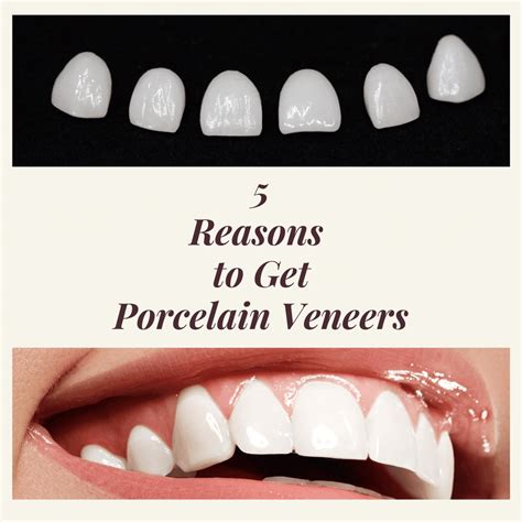 Fondriest will sometimes remove a small amount of enamel. 5 Reasons to Get Veneers - Empire Dental
