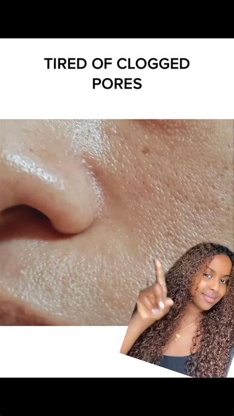 How To Get Rid Of Clogged Pores Moisturizer For Oily Skin Skin Care