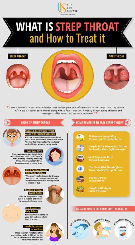 Ultimate Guide To Combat Warning Signs Of Strep Throat With Images Strep Throat Signs Of