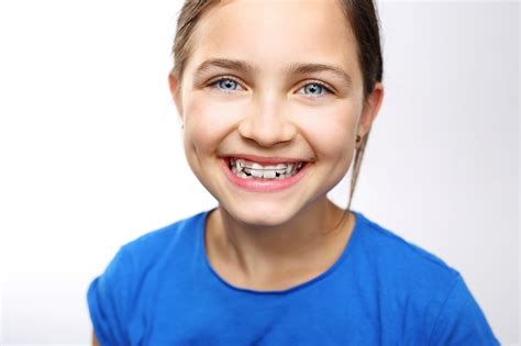 Nhs Patients The London Orthodontic Group