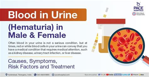 Blood In Urine Hematuria Causes Concerns And Care