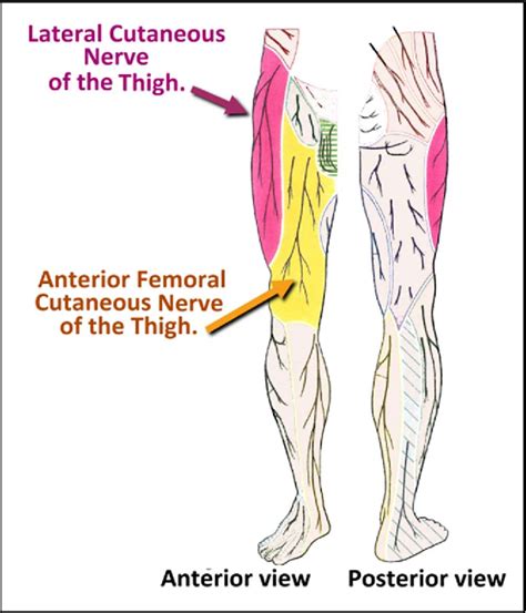 Anterior Femoral Cutaneous Nerve Numbness