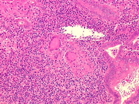 Aug 25, 2021 · a general definition of adverse health effect is any change in body function or the structures of cells that can lead to disease or health problems. Histopathology of the uterine cervix - digital atlas