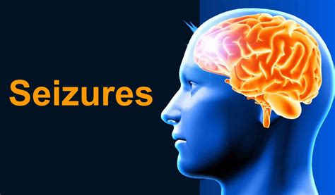 Seizures Types Causes Symptoms Diagnosis And Treatment