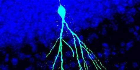 Image Of The Day Newborn Neuron The Scientist Magazine®