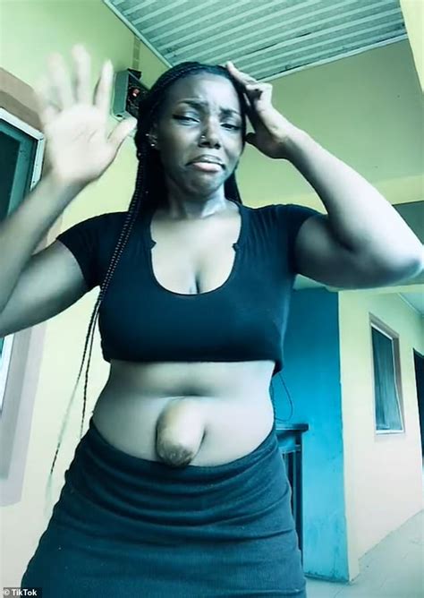 Woman Goes Viral By Showing Off Her Protruding Belly Button In Crop