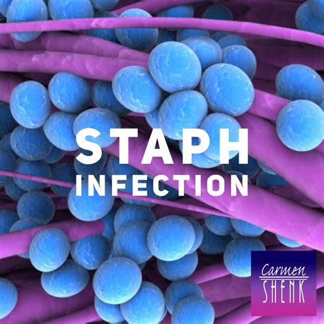 Staph Infection Shenkblog