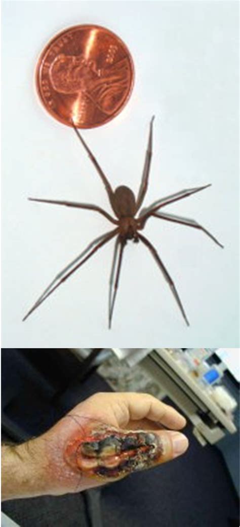 Naturally Treating Brown Recluse Spider Bites Brown Recluse Spider