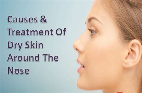 Check spelling or type a new query. Know the Causes and Treatments of Dry Skin Around The Nose