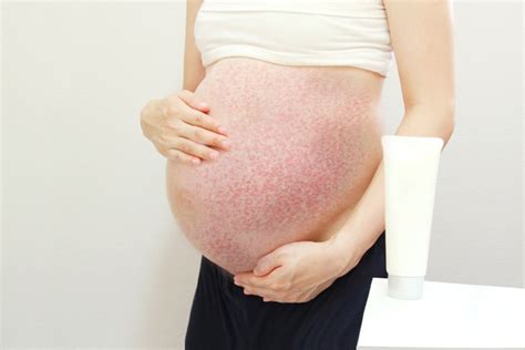 Using Nair On Belly While Pregnant Pregnantbelly