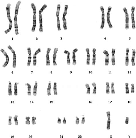Chromosome 14 spans about 107 million base pairs (the building material of dna) and represents between 3 and 3.5% of the total dna in cells. Chromosomes and Chromosomal Abnormalities | Neupsy Key