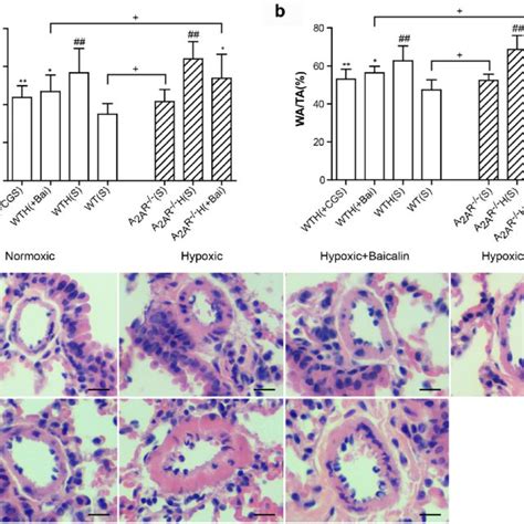 The A A R And Baicalin Reduced Pulmonary Arterial Remodeling In The