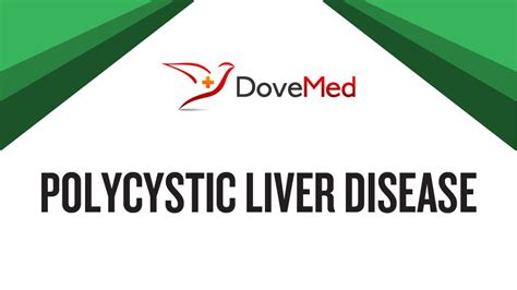 Polycystic liver disease (pld) is the result of embryonic ductal plate malformation of the intrahepatic biliary tree. Polycystic Liver Disease