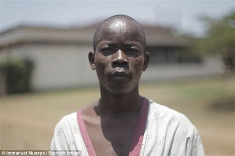Kenianischer Mann Mit Den Gr Ten Hoden Der Welt L Sst Sich Operieren
