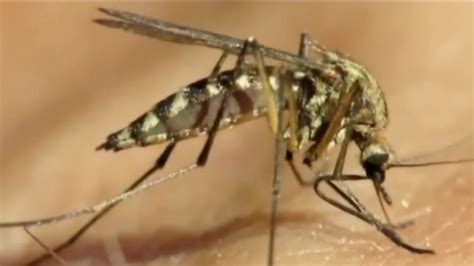 Orange County Child Recovering After Being Diagnosed With West Nile