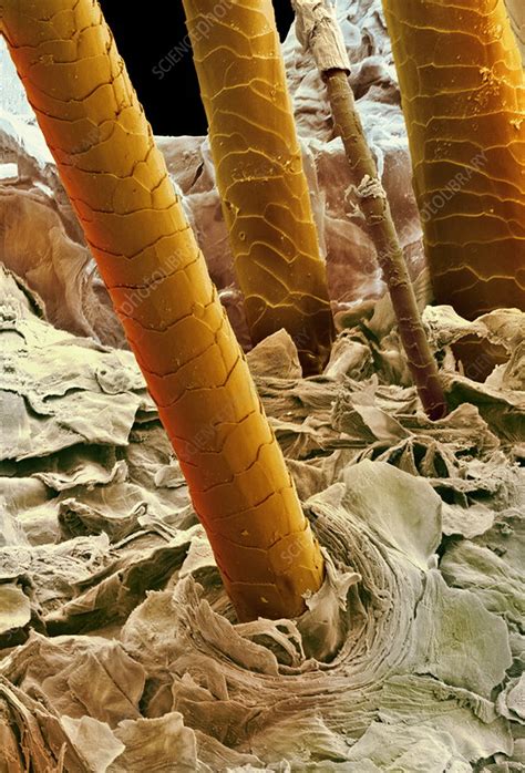 Human Hair Under Electron Microscope