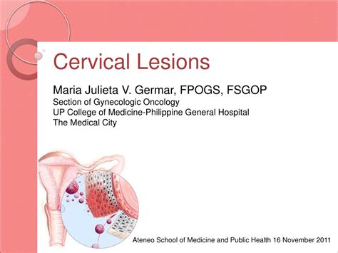 Ppt Cervical Lesions Powerpoint Presentation Free Download Id5911047