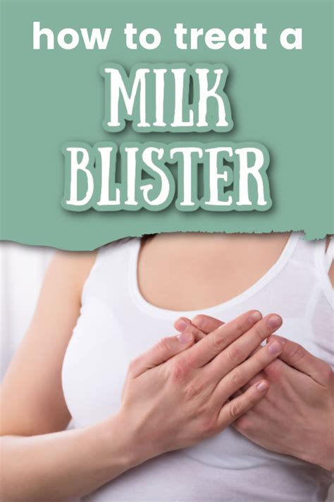 How To Treat A Milk Blister When Youre Exclusively Pumping