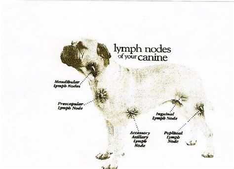 Stage 2 Cancer Lymph Nodes