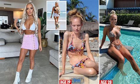 Anorexia Survivor Whose Weight Plummeted To Just Kilos Shares Recovery Daily Mail Online