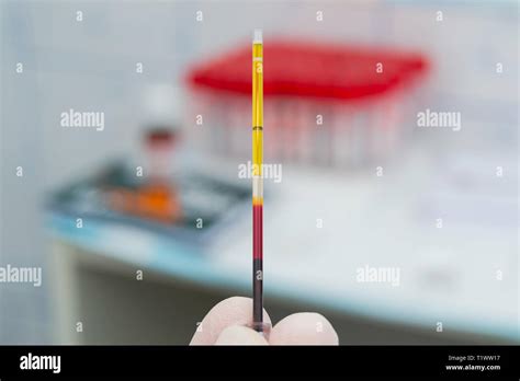 Centrifuged Blood Hi Res Stock Photography And Images Alamy