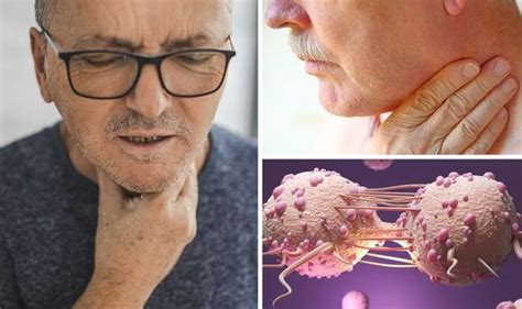 Throat Cancer Symptoms The Most Common Symptoms Of The Deadly Disease