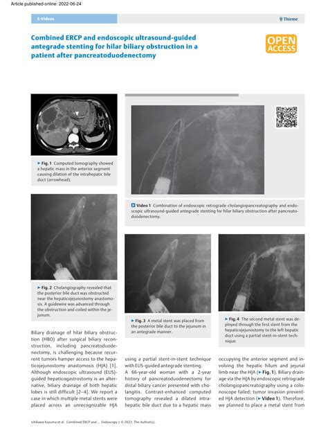 Pdf Combined Ercp And Endoscopic Ultrasound Guided Antegrade Stenting