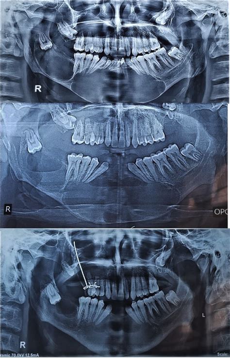 Presentation And Management Of Syndromic And Non Syndromic Patients