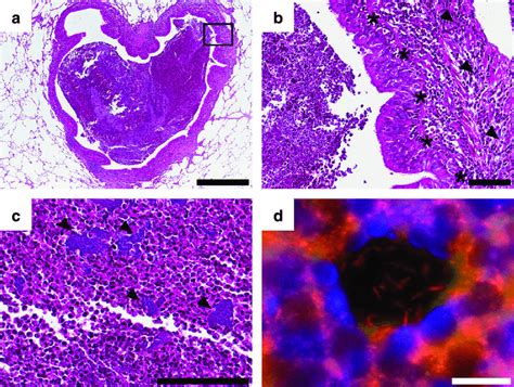 Cystic fibrosis | care guidelines for nutrition management. Histological analysis of the cystic fibrosis (CF) lung ...