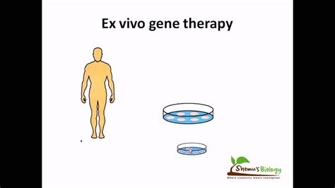 Ex Vivo Gene Therapy YouTube