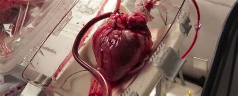 Human body is a complex combination of many body parts. New 'Heart-in-a-Box' Device Revives Dead Hearts For Transplant