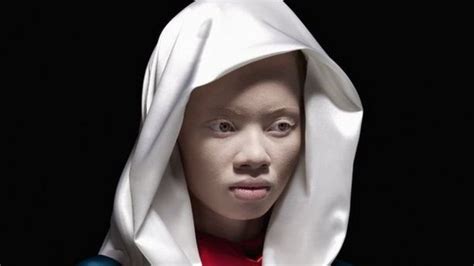 In Pictures Albinism And Perceptions Of Beauty Bbc News