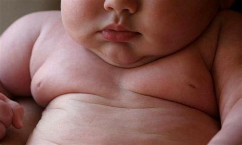 obesidad también en niños es indicador de alto riesgo cardíaco infobae