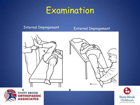 Ppt Hip Impingement In The Athlete Open Approaches Powerpoint